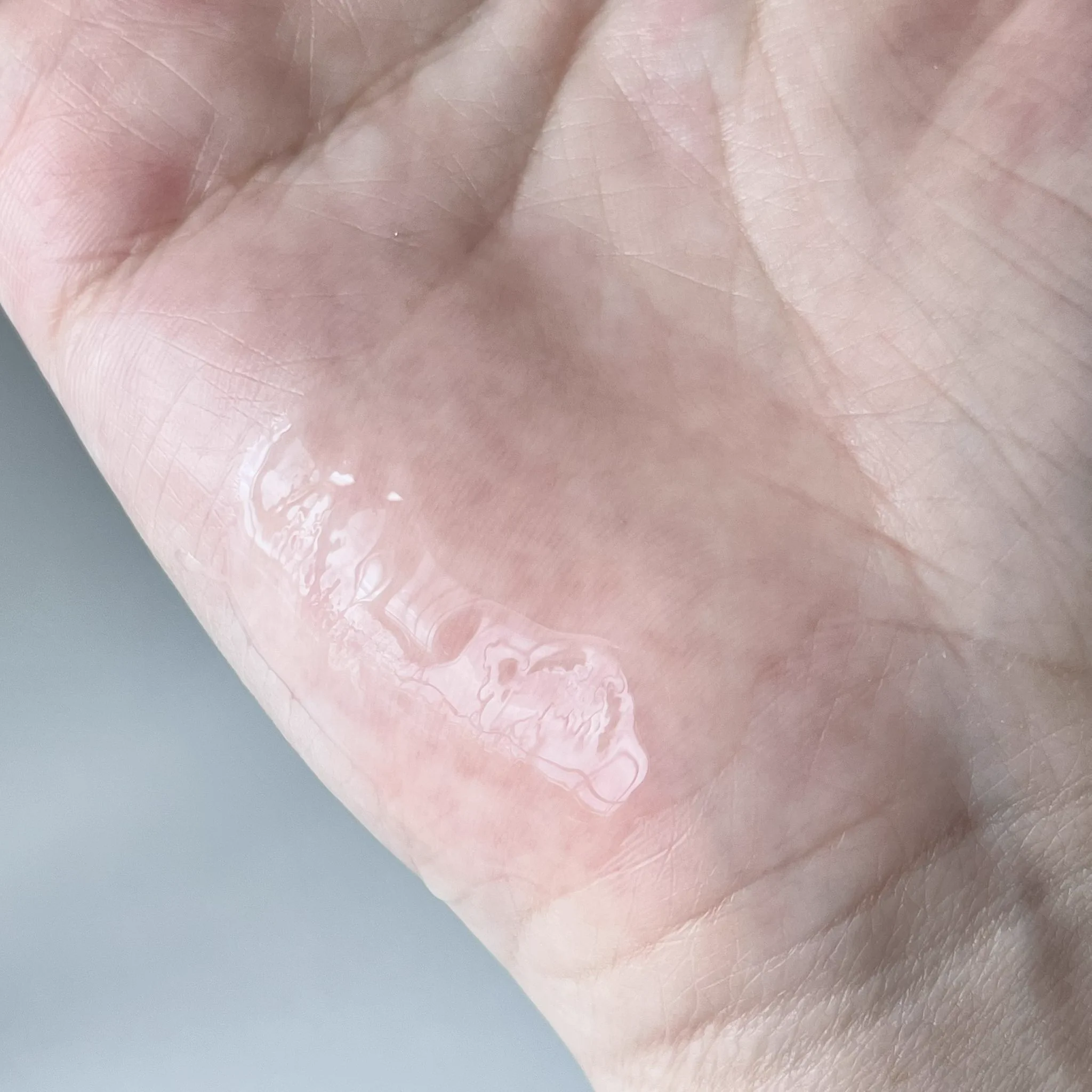 ใครเป็นสิวอุดตัน ไม่ต้องไปบีบไปเค้นให้เจ็บอีกต่อไป~ ลองลาโรชขวดนี้เลยค่า Effaclar serum ตัวนี้ช่วยสลายสิวอุดตัน คือตัดจบปัญหาสิวไปได้เลยเซรั่มจบปัญหาสิวที่ต้นตอ ไม่ว่าจะสิวอักเสบ อุดตัน หรือ สิวเสี้ยน สิวบุกเมื่อไหร่ต้องรีบหยิบตัวนี้มาใช้เลย🩵https://t.co/ud0F0WoKK7 🩵https://t.co/Aj9SGCI2lq#LaRochePosayTH #Effaclar #ลาโรชโพเซย์ #เอฟฟาคลาร์ #สลายสิว #เอฟฟาคลาร์เซรั่ม #EffaclarSerum #รอยสิว #สิวอุดตัน