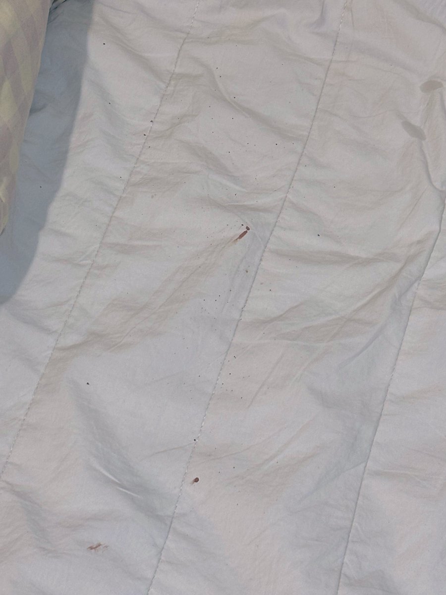 現在才發現…
前幾天浴血奮戰的痕跡…
居然是噴灑式的點狀痕跡哈哈哈哈
本來想說奇怪怎麼床單那麼多一點一點黑黑的髒東西
哭啊我的床單就這麼毀了嗎？ https://t.co/6BoFIprrar