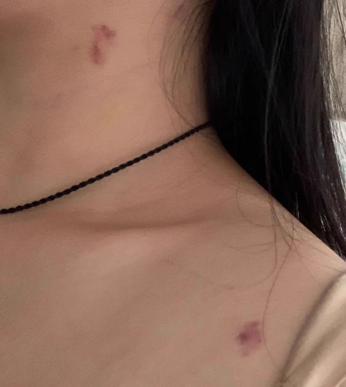 那个叫什么龙龙的弟弟，你这么做有意思吗？趁我睡觉往我脖子上种几个草莓，你让我怎么见我的同事，朋友？真不知道你是怎么想的，还把用过的套，从垃圾桶里捡起来，放到我的床头，恶不恶心啊你，真特么的服你了，趁我睡着了偷偷跑路，完事还把我拉黑，真的办的不是人事！真是服了…… https://t.co/8yMurAJqzP