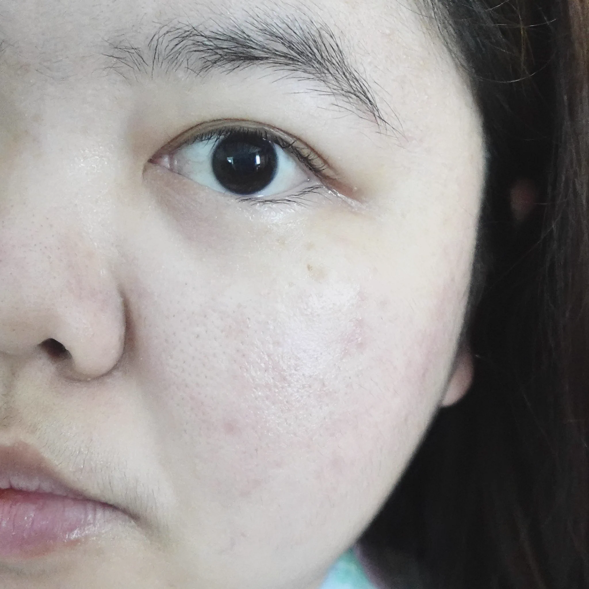 เอาจริงนะ สิ่งนี้ทุกคนต้องมีไว้ใช้ปราบสิวค่ะค่ะ! ใช้มาตั้งแต่วัยรุ่นนะ Effaclar Duo+M ของลาโรช เป็นมอยเจอร์ไรเซอร์ที่บำรุงได้ ปลอบประโลมผิวดี ลดสิวจากต้นตอ เพราะมีตัว PHYLOBIOMA โมเลกุลที่ช่วยปรับสมดุลผิว ลดความมัน ทำให้ช่วยลดการเกิดสิว แล้วช่วยลดรอยจากสิวด้วย ก็คือครบ จบ หมดก็ซื้อวนไป หลอดที่ n 🙌🏻 ต้องมี ต้องซื้อ ต้องซ้ำ !