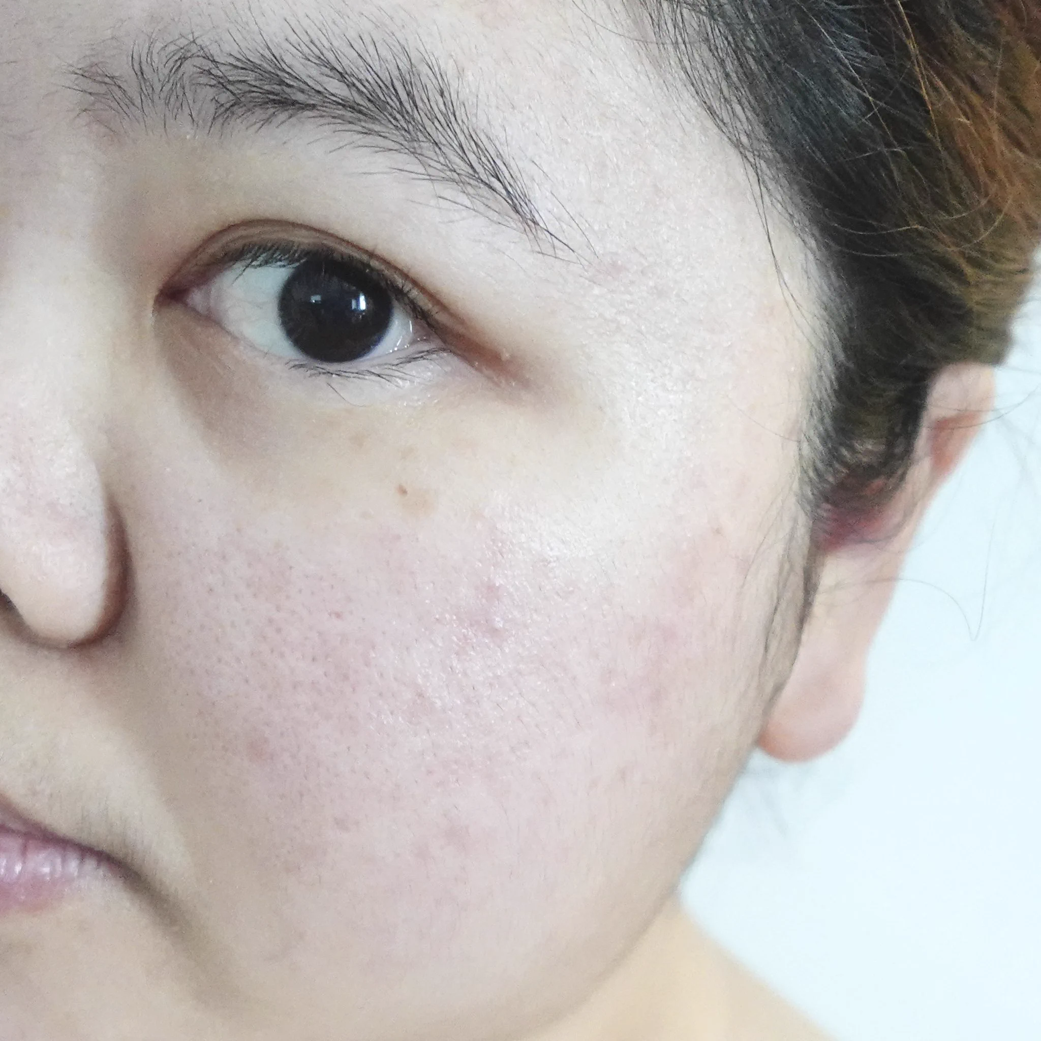 เอาจริงนะ สิ่งนี้ทุกคนต้องมีไว้ใช้ปราบสิวค่ะค่ะ! ใช้มาตั้งแต่วัยรุ่นนะ Effaclar Duo+M ของลาโรช เป็นมอยเจอร์ไรเซอร์ที่บำรุงได้ ปลอบประโลมผิวดี ลดสิวจากต้นตอ เพราะมีตัว PHYLOBIOMA โมเลกุลที่ช่วยปรับสมดุลผิว ลดความมัน ทำให้ช่วยลดการเกิดสิว แล้วช่วยลดรอยจากสิวด้วย ก็คือครบ จบ หมดก็ซื้อวนไป หลอดที่ n 🙌🏻 ต้องมี ต้องซื้อ ต้องซ้ำ !