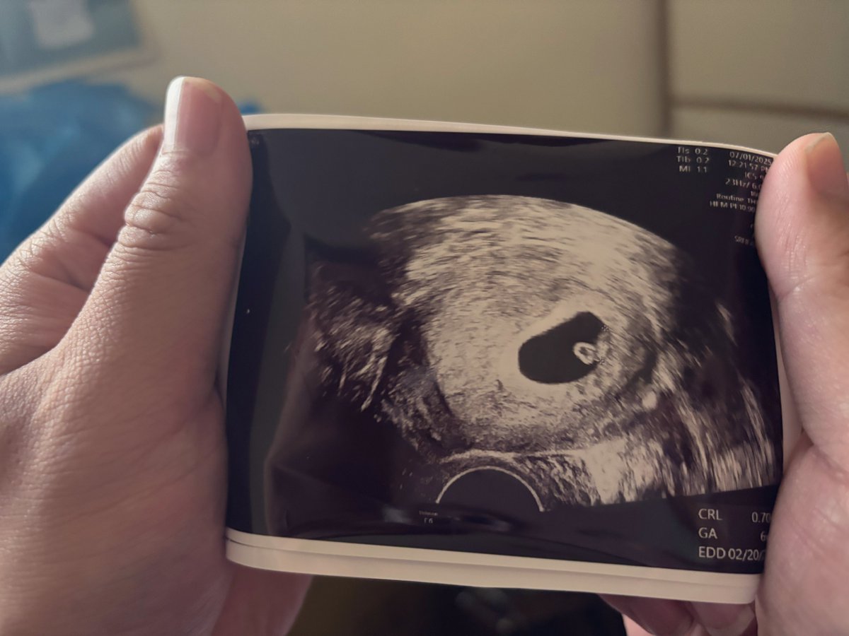 記錄下世界崩塌的那幾天
心情到現在都還很複雜…
事情發生到現在已經隔一段時間了我才敢放上來
因為前陣子太糟糕了不希望得到太多關注
但我還是很想為這人生中的重大事件寫一篇文紀念

我想跟祢說對不起
現在的我還沒有能力留下祢
但我是真的很希望祢能開開心心回去當個快樂的小天使
待更好的時機到來時
再回到我身邊好嗎