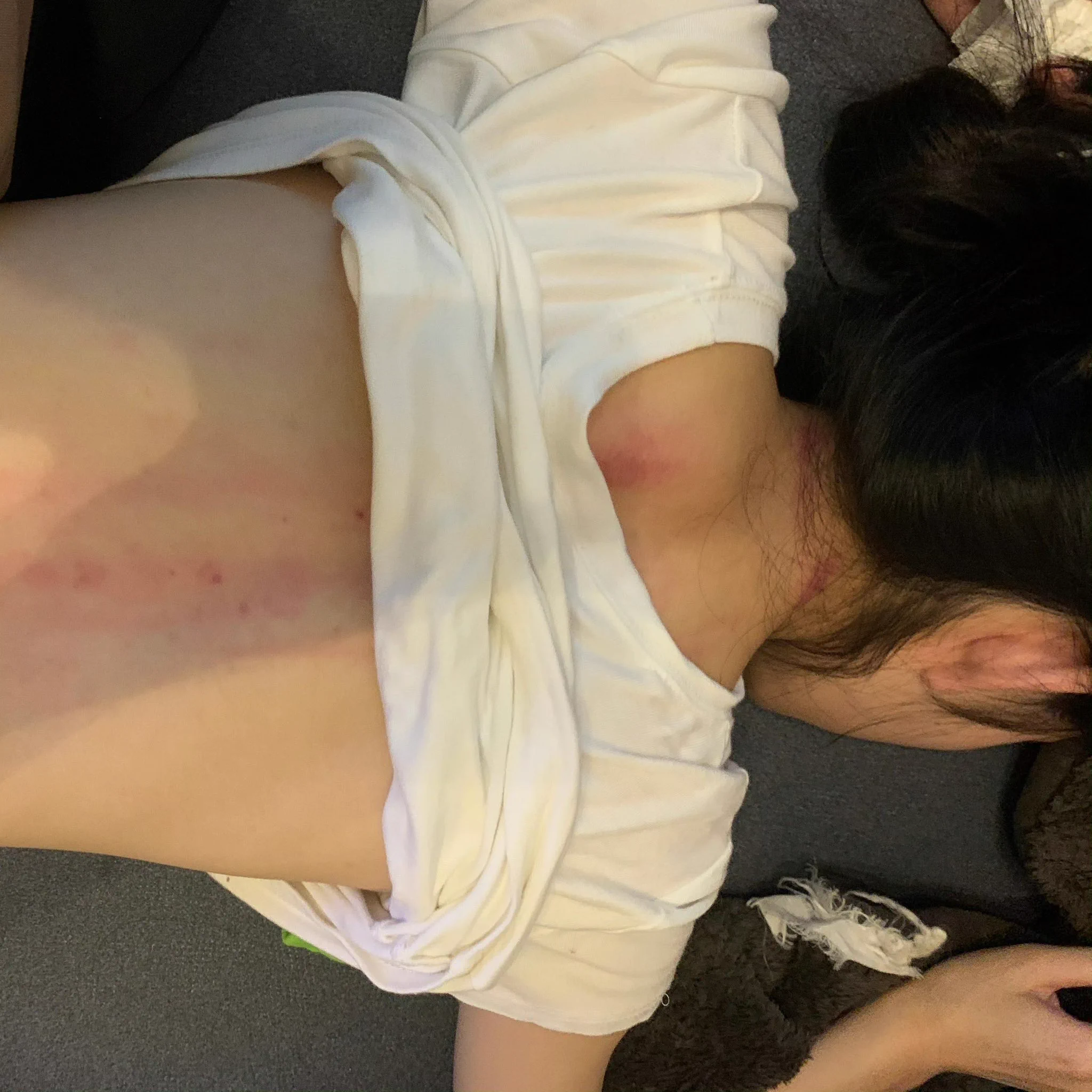 刮痧到底有啥好处 https://t.co/ARuvM490nK