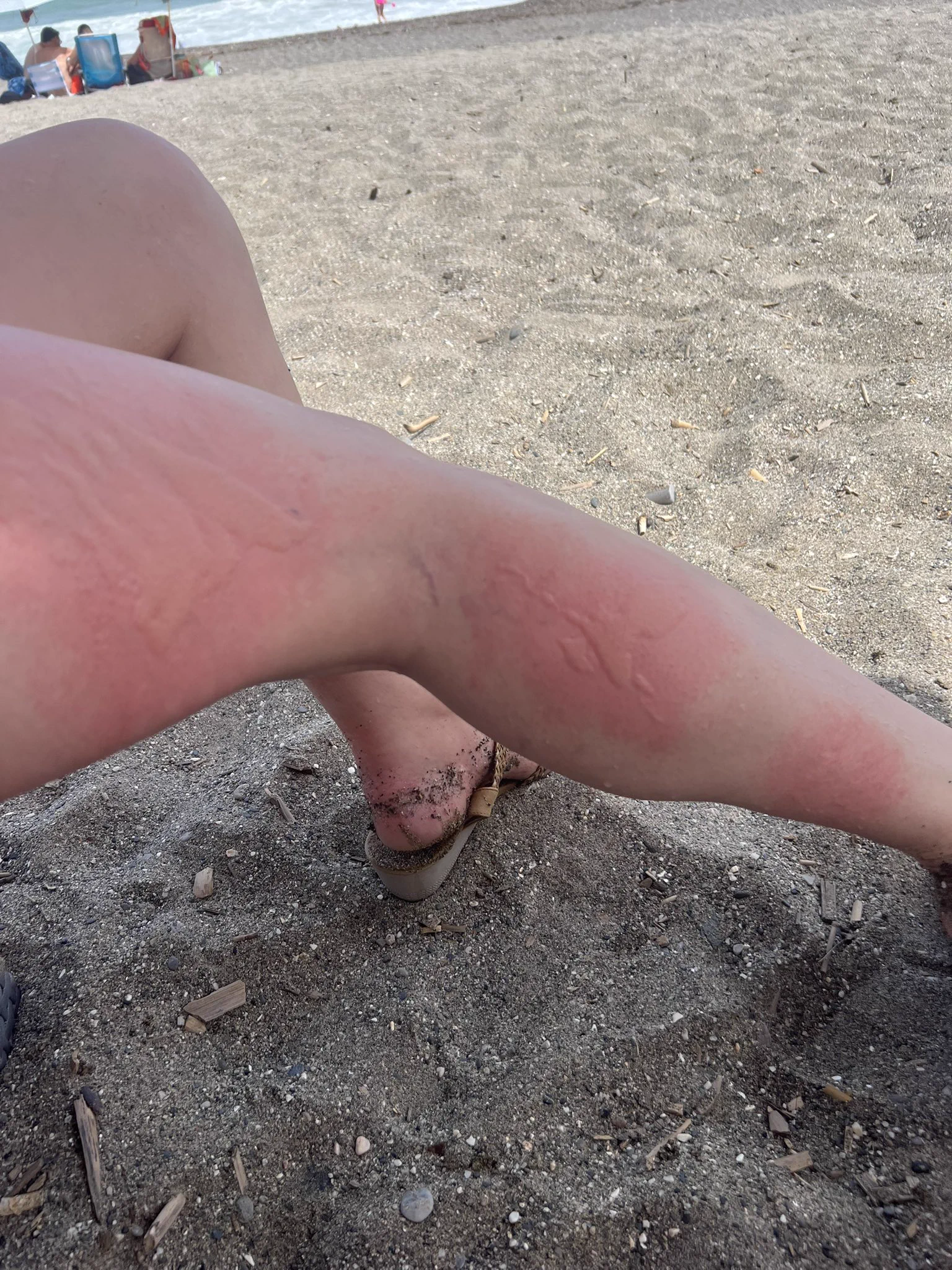 32° weather ✅
Beach club ✅
Nice cocktail ✅

Getting stung by a jellyfish 😩 https://t.co/xF3iSUhied