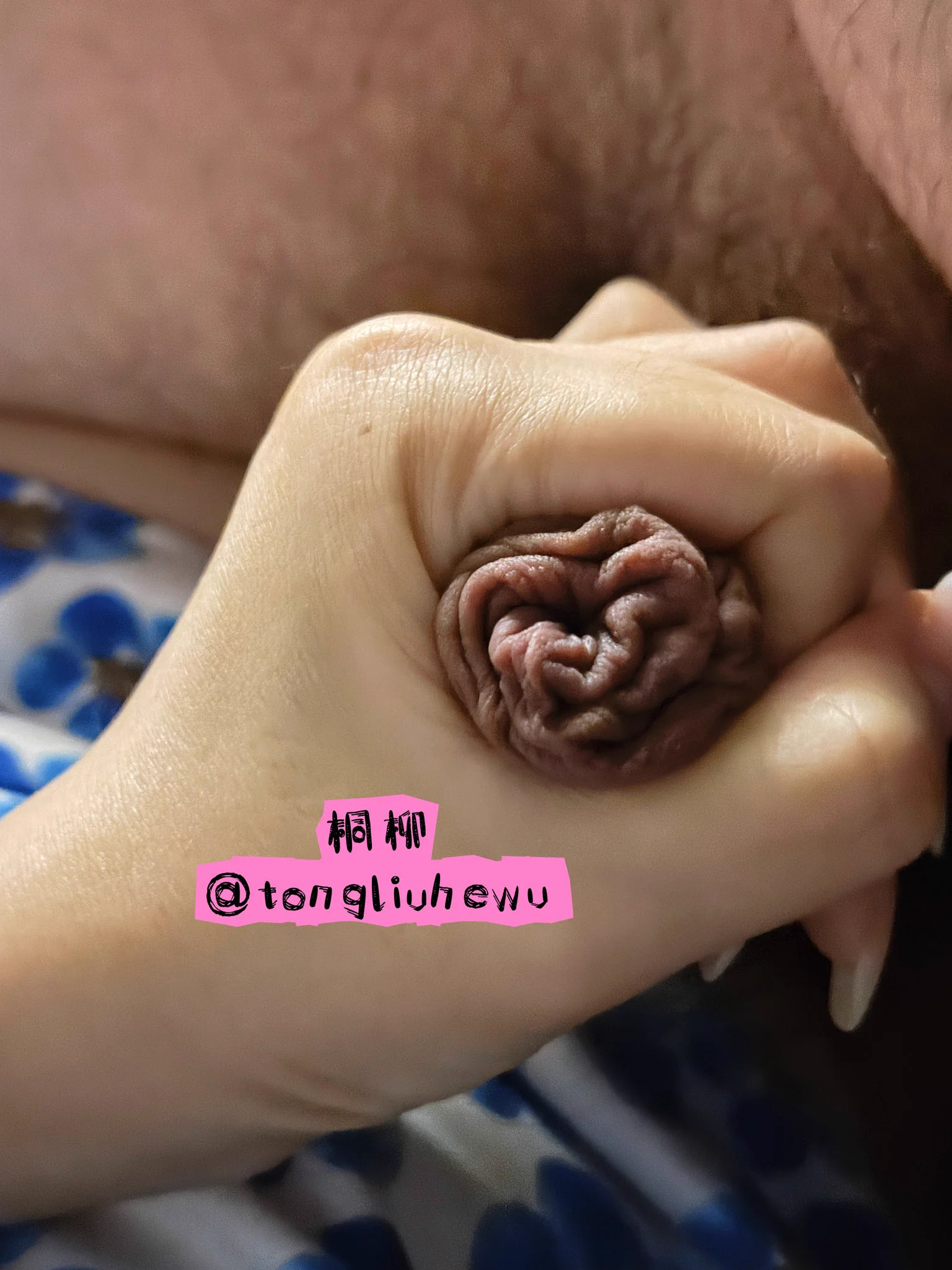 包皮玫瑰🥀哈哈 https://t.co/i1u8nFKr7e