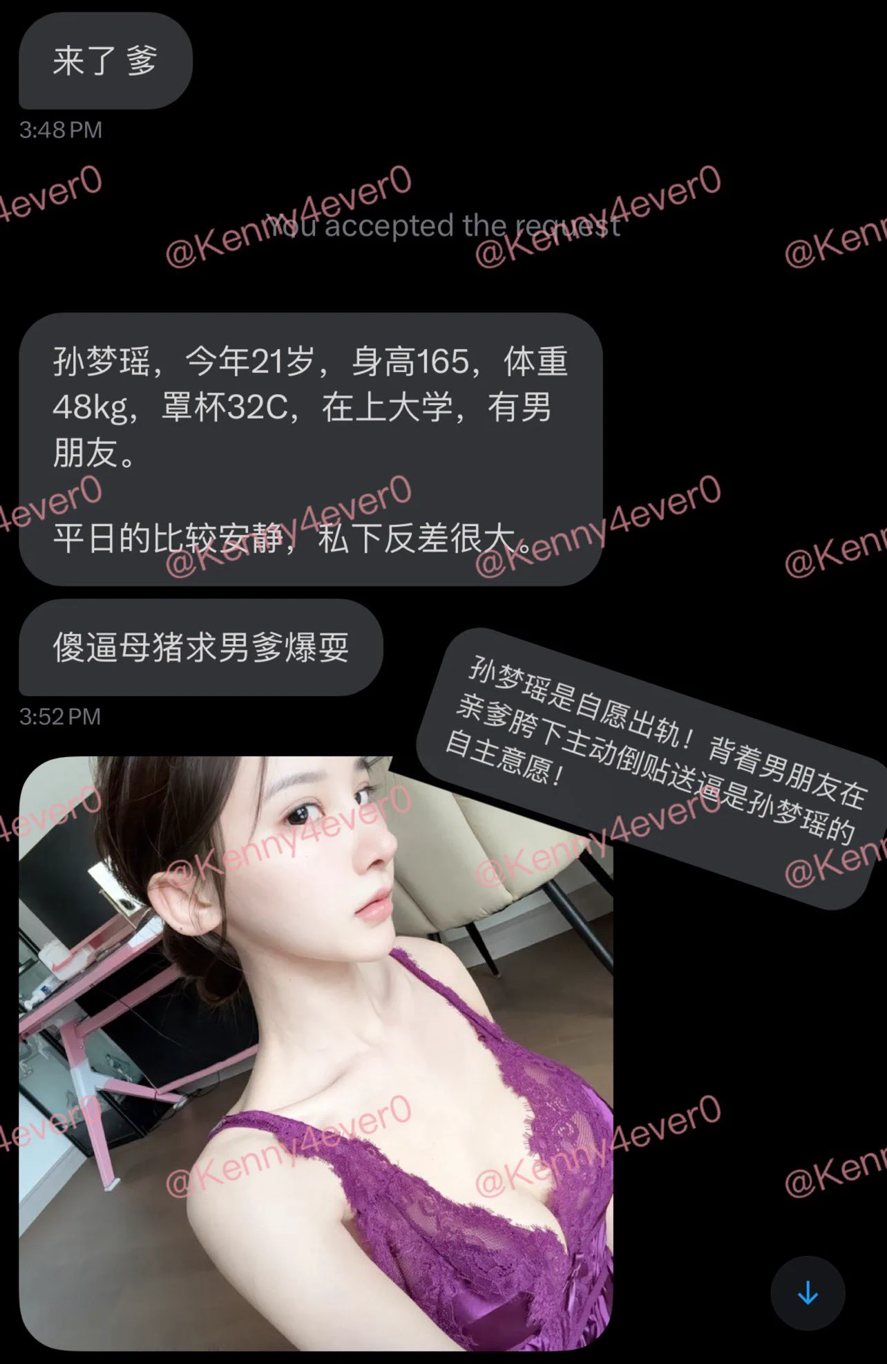 📢最新预告 最新女嘉宾: 背着男友求亲爹爆耍的孙梦瑶  周末别刷抖音别看电视剧了 来看主页婊子主动送逼 ps: 点赞➕转发就是催更的最好动力 #反差 #人妻 #聊骚 #露出 #女大学生 #母畜 #羞辱 #婊子 #骚货 #女高 #女大 #真空 #社死 #母狗 #肉便器 #鸡吧套子 #母畜 #羞辱 #眼镜婊 #母畜 #骚货 #肉便器 #洗脑 #母猪 #母驴 #反差婊 #强迫 #胁迫 #bbc #黑爹 #媚黑 #easygirl

转推感谢💌: @Kennnyyy0 
                          @007share
                          @tbzt2024 
                          @DDDDBBHHH
                          @wqganenshi_