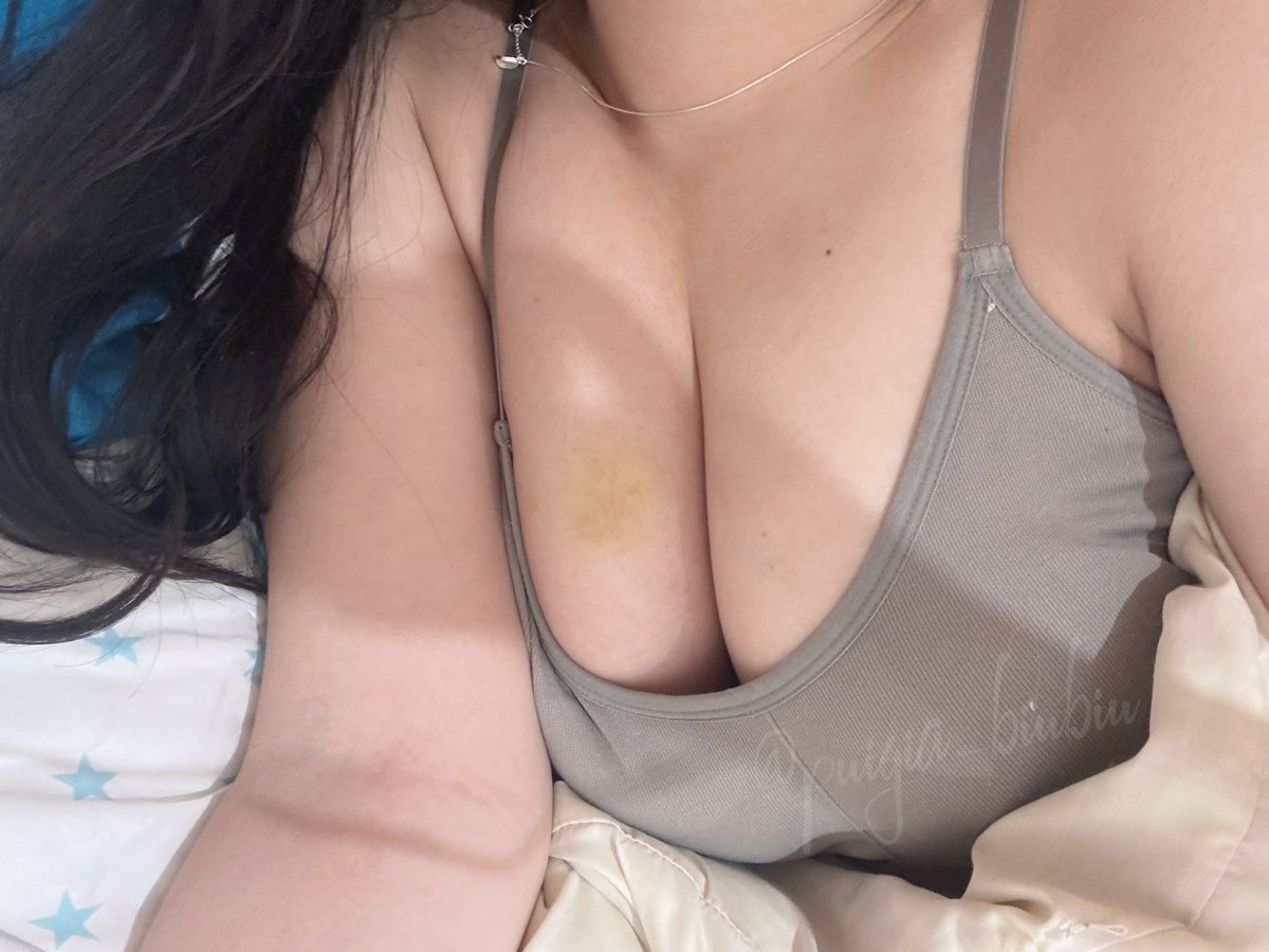雖然說我蠻喜歡被啃的
喜歡被索取
喜歡被留下痕跡
但這屬實是啃的有點用力了…
好大一片
嗚嗚當下有夠痛ㄉ😭😭 https://t.co/QazjdYXA6e
